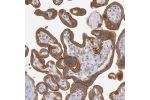 Immunohistochemical staining of human placenta shows strong cytoplasmic and membranous positivity in trophoblastic cells.