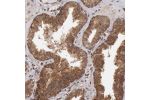 Immunohistochemical staining of human prostate shows moderate cytoplasmic positivity in glandular cells.