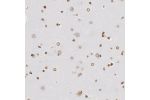Immunohistochemical staining of human cerebral cortex shows moderate to strong positivity in nuclear membrane in neuronal cells and glial cells.