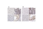 Immunohistochemical staining of human cerebral cortex, colon, liver and testis using Anti-DGCR14 antibody HPA001221 (A) shows similar protein distribution across tissues to independent antibody HPA001222 (B).