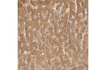 Immunohistochemical staining of human liver shows moderate cytoplasmic positivity in hepatocytes.