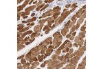 Immunohistochemical staining of human heart muscle shows strong cytoplasmic positivity in myocytes.