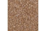 Immunohistochemical staining of human liver shows strong granular cytoplasmic positivity in hepatocytes.