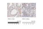 Immunohistochemistry analysis in human testis and kidney tissues using Anti-RGAG1 antibody. Corresponding RGAG1 RNA-seq data are presented for the same tissues.