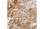 Immunohistochemical staining of human skeletal muscle shows moderate granular positivity in cytoplasm in myocytes.
