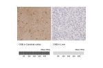 Immunohistochemistry analysis in human cerebral cortex and liver tissues using HPA001254 antibody. Corresponding CKB RNA-seq data are presented for the same tissues.