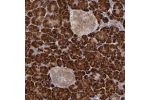Immunohistochemical staining of human pancreas shows strong cytoplasmic positivity in exocrine glandular cells.