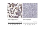 Immunohistochemistry analysis in human bone marrow and pancreas tissues using HPA001295 antibody. Corresponding FCN1 RNA-seq data are presented for the same tissues.