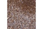 Immunohistochemical staining of human spleen shows cytoplasmic positivity in white pulp and sinusoids.