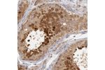 Immunohistochemical staining of human testis shows moderate to strong cytoplasmic and nuclear positivity in cells in seminiferous ducts.