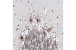 Immunohistochemical staining of human cerebellum shows strong nuclear positivity in Purkinje cells.