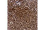 Immunohistochemical staining of human tonsil shows strong cytoplasmic positivity in cells in seminiferus ducts.