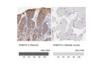 Immunohistochemistry analysis in human stomach and skeletal muscle tissues using HPA001333 antibody. Corresponding RAB27A RNA-seq data are presented for the same tissues.