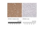 Immunohistochemistry analysis in human cerebral cortex and liver tissues using HPA001356 antibody. Corresponding MYO5A RNA-seq data are presented for the same tissues.