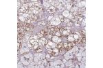 Immunohistochemical staining of human adrenal gland shows moderate membranous positivity in glandular cells.