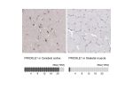 Immunohistochemistry analysis in human cerebral cortex and skeletal muscle tissues using HPA001379 antibody. Corresponding PRICKLE1 RNA-seq data are presented for the same tissues.
