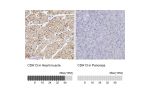 Immunohistochemistry analysis in human heart muscle and pancreas tissues using HPA001380 antibody. Corresponding CDH13 RNA-seq data are presented for the same tissues.