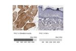 Immunohistochemistry analysis in human skeletal muscle and skin tissues using Anti-FHL1 antibody. Corresponding FHL1 RNA-seq data are presented for the same tissues.