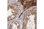 Immunohistochemical staining of human testis shows strong cytoplasmic and nuclear positivity in Leydig cells and basal cells in the seminiferous ducts.