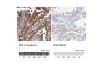 Immunohistochemistry analysis in human duodenum and testis tissues using HPA001399 antibody. Corresponding ADA RNA-seq data are presented for the same tissues.