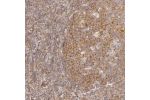 Immunohistochemical staining of human tonsil shows strong cytoplasmic positivity in germinal center cells.