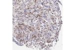 Immunohistochemical staining of human retina, inner nuclear layer, shows moderate nuclear positivity.