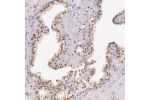 Immunohistochemical staining of human prostate shows nuclear positivity in glandular cells.