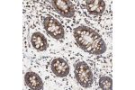 Immunohistochemical staining of human colon shows strong cytoplasmic positivity in glandular cells.