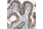 Immunohistochemical staining of human gallbladder shows cytoplasmic positivity in glandular cells.