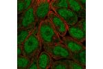 Immunofluorescent staining of human cell line RT4 shows localization to nucleoplasm & cytosol.