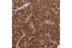 Immunohistochemical staining of human pancreas shows strong cytoplasmic positivity in exocrine glandular cells.