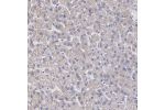 Immunohistochemical staining of human liver shows weak cytoplasmic positivity in hepatocytes.