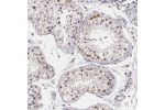 Immunohistochemical staining of human Testis shows moderate nuclear positivity in spermatogonia.