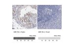 Immunohistochemistry analysis in human testis and tonsil tissues using HPA001500 antibody. Corresponding SMC1B RNA-seq data are presented for the same tissues.
