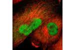 Immunofluorescent staining of human cell line U-251 MG shows localization to nucleoplasm & cytosol.
