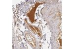 Immunohistochemical staining of human small intestine shows positivity in plasma.