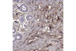 Immunohistochemical staining of human breast shows moderate to strong cytoplasmic positivity.