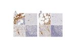 Immunohistochemical staining of human bone marrow, cerebral cortex, liver and lymph node using Anti-AHSG antibody HPA001525 (A) shows similar protein distribution across tissues to independent antibody HPA001524 (B).