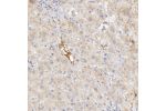 Immunohistochemical staining of human liver shows cytoplasmic positivity in hepatocytes.