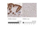 Immunohistochemistry analysis in human stomach and liver tissues using Anti-IFNGR2 antibody. Corresponding IFNGR2 RNA-seq data are presented for the same tissues.