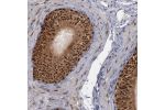 Immunohistochemical staining of human epididymis shows strong nuclear and cytoplasmic positivity in glandular cells.