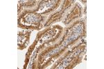 Immunohistochemical staining of human duodenum shows moderate cytoplasmic and nuclear positivity in glandular cells.