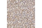 Immunohistochemical staining of human liver shows cytoplasmic positivity in hepatocytes.
