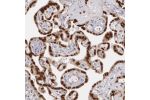 Immunohistochemical staining of human placenta shows strong nuclear positivity in trophoblastic cells.
