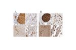 Immunohistochemical staining of human colon, kidney, liver and lung using Anti-C4BPA antibody HPA001578 (A) shows similar protein distribution across tissues to independent antibody HPA000926 (B).