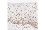Immunohistochemical staining of human cervix, uterine shows moderate nuclear positivity in keratinocytes.
