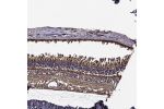 Immunohistochemical staining of human eye, retina shows strong cytoplasmic positivity.