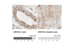 Immunohistochemistry analysis in human testis and skeletal muscle tissues using Anti-DNMT3B antibody. Corresponding DNMT3B RNA-seq data are presented for the same tissues.