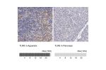 Immunohistochemistry analysis in human appendix and pancreas tissues using Anti-TLR8 antibody. Corresponding TLR8 RNA-seq data are presented for the same tissues.