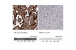 Immunohistochemistry analysis in human placenta and liver tissues using HPA001612 antibody. Corresponding FBLN1 RNA-seq data are presented for the same tissues.